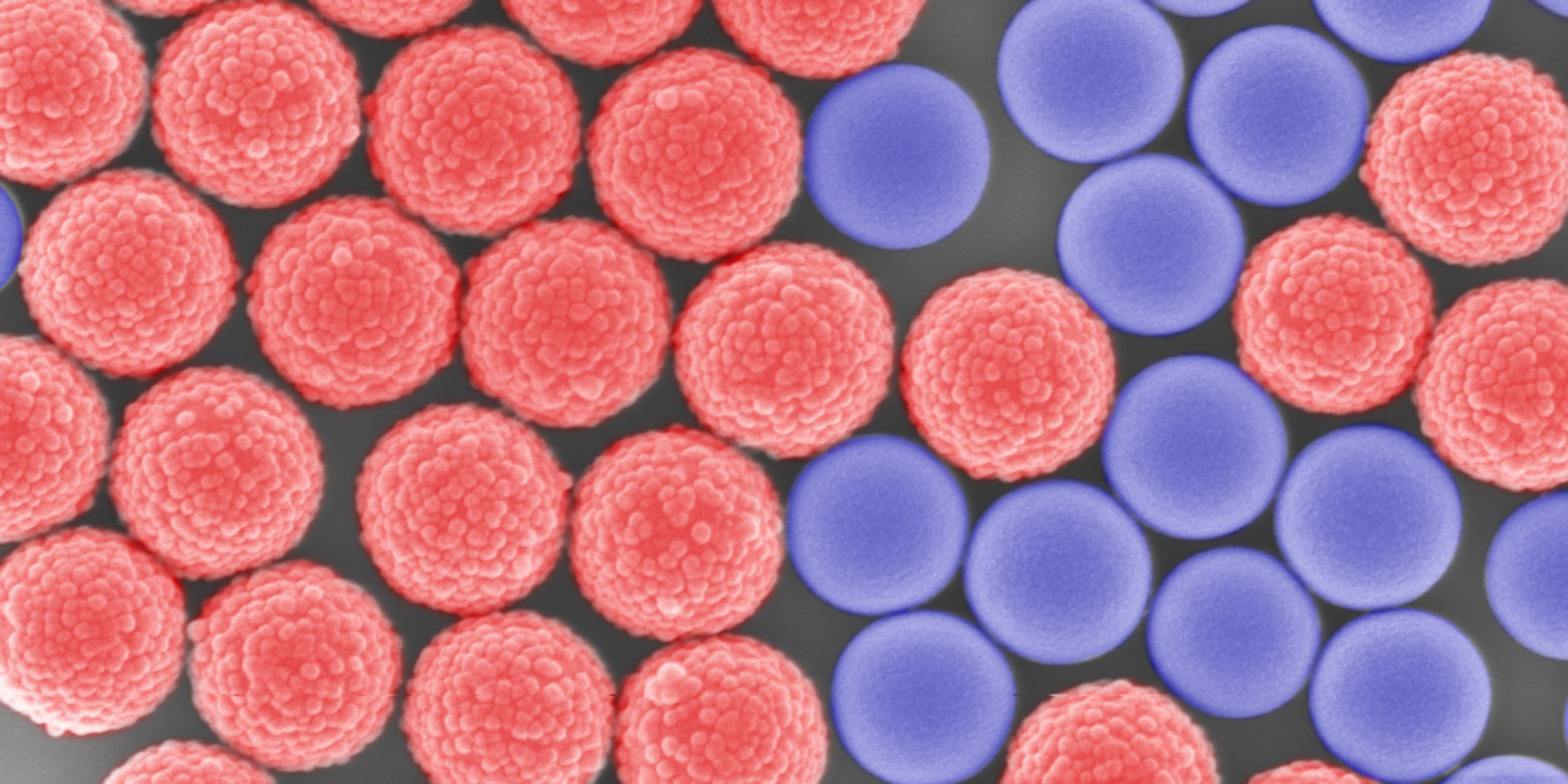 Rough and smooth particles in a suspension: Their mixing ratio influences the time of the sudden increase in viscosity. (SEM image: Chiao-Peng Hsu, ETH Zurich)